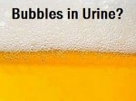tiny bubbles in urine